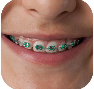 ROTH